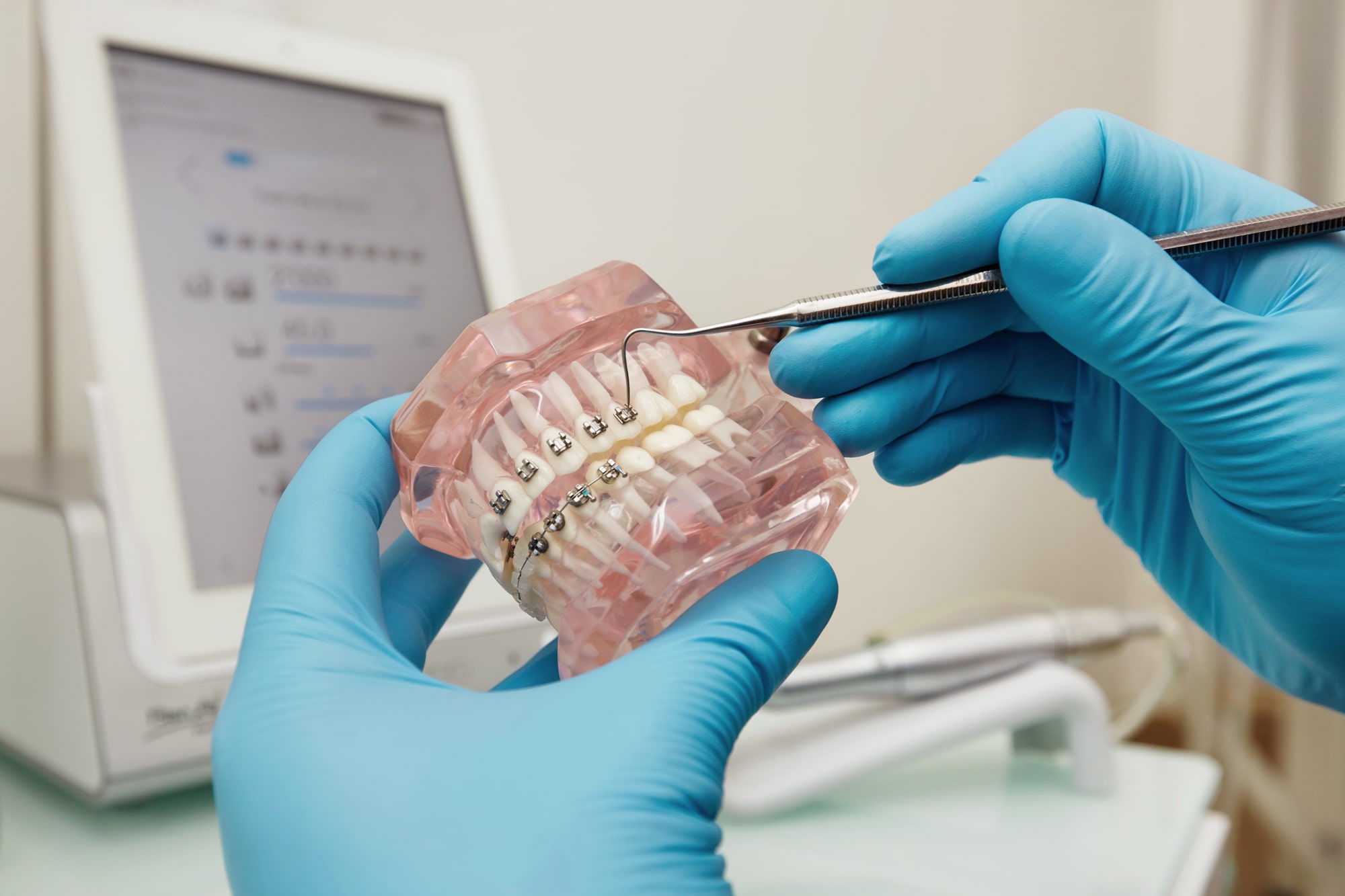 dentist-holding-dental-plastic-model-with-braces-min