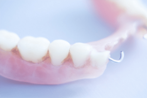 protesis-dental-clinica-blanco-carrion