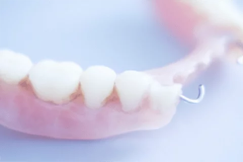 protesis-dental-clinica-blanco-carrion