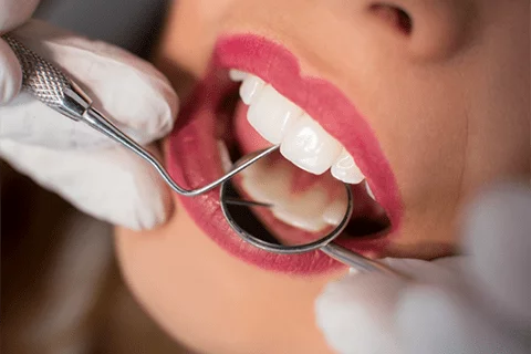 endodoncia-clinica-blanco-carrion